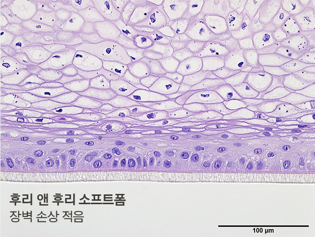 후리 앤 후리 소프트폼, 장벽 손상 적음