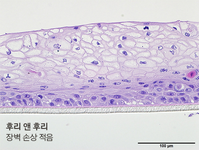 후리 앤 후리, 장벽 손상 적음