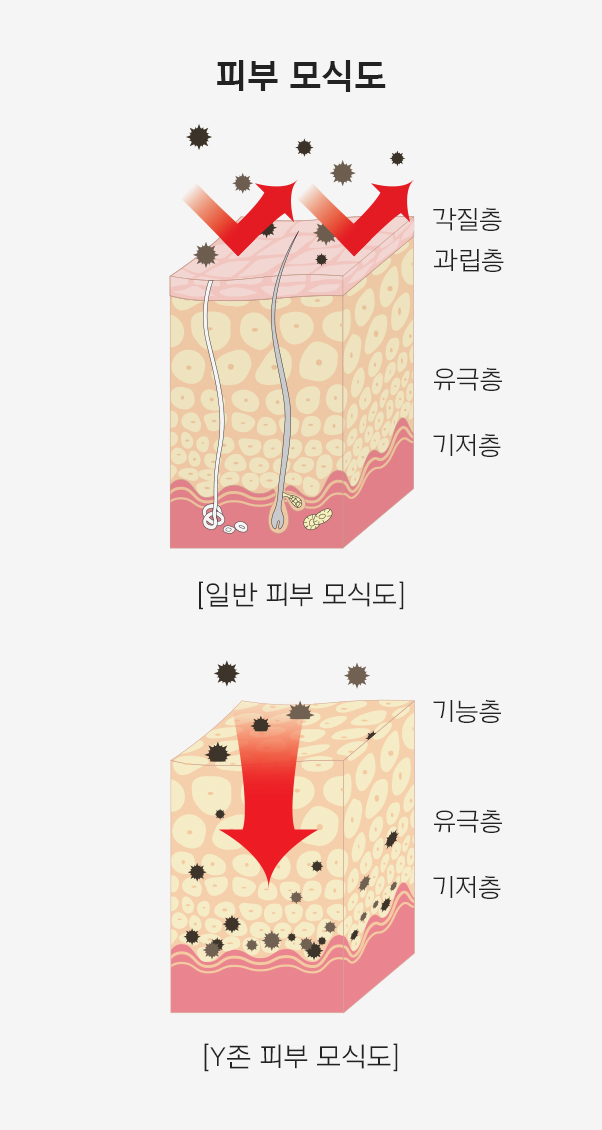 일반 피부에 비해 Y존 피부에 침투가 잘되는 모식도