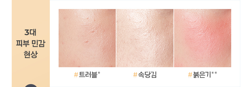 3대 피부 민감 현상 : # 트러블*, # 속당김, # 붉은기** +