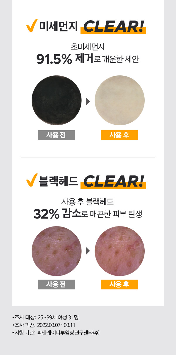 퍼펙트 오일 투 폼클렌저 사용 후 효과