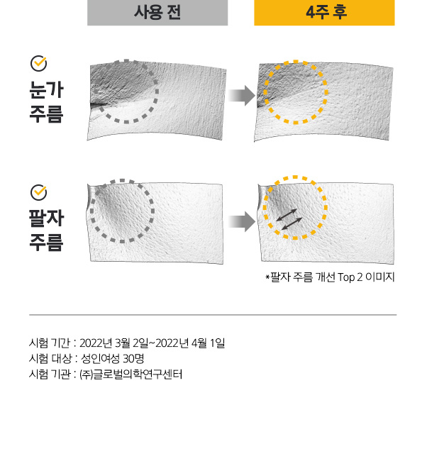 사용 전, 4주 후 눈가 주름과 팔자 주름 개선 된 모습. *팔자 주름 개선 Top 2 이미지. 시험 기간 : 2022년 3월 2일~2022년 4월 1일 / 시험 대상 : 성인여성 30명 / 시험 기관 : ㈜글로벌의학연구센터