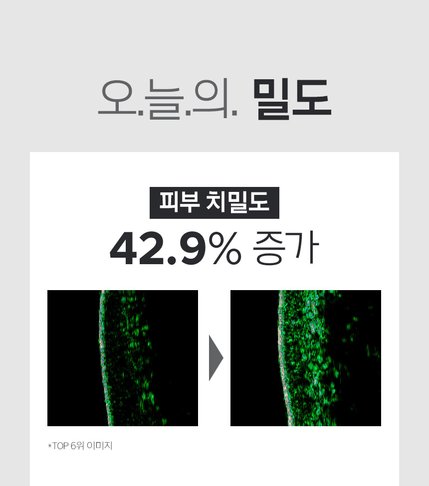 오늘의 밀도/피부 치밀도 42.9% 증가/*TOP 6위 이미지